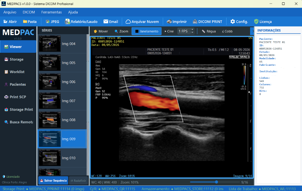 MEDPACS Doppler de Carótida